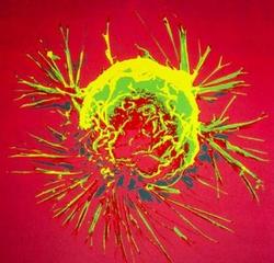 Cancer-fighting gene also delays ageing
