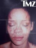 Picture of bruised Rihanna sparks police probe