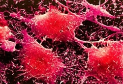 Scientists cure cancer with modified cells