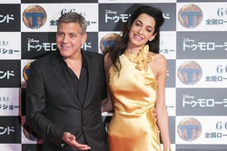 Bony Amal Clooney was suspected of anorexia