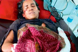 54-year-old woman won the battle with leopard