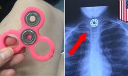 To dispel the myth about the impact of spinners on the child