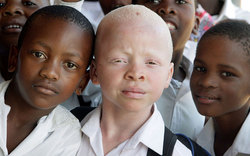In Africa barbarians prey on children with albinism