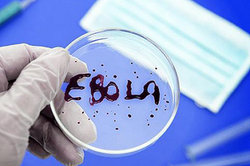 In Canada, the laboratory worker has contracted Ebola