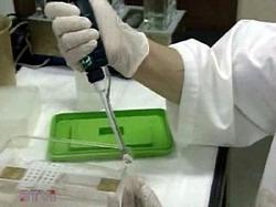 5-year old child died from bird flu in Thailand