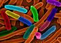Deadly E. coli was engineered