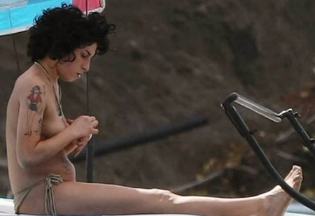 Amy Winehouse hospitalised after  "leaking" of her breast implants