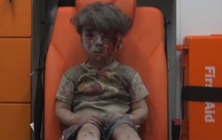 The little boy in Aleppo was a vivid reminder of the horrors of war