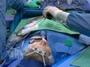 Healing hearts: short scalpel-free surgery saves lives